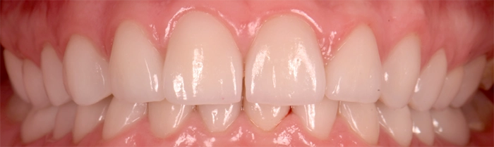 Saint Clair Dentaire – Dentisterie esthétique