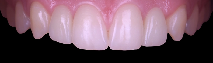 Saint Clair Dentaire – Dentisterie esthétique