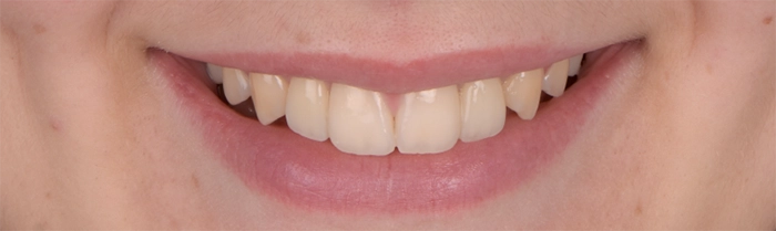 Saint Clair Dentaire – Dentisterie esthétique