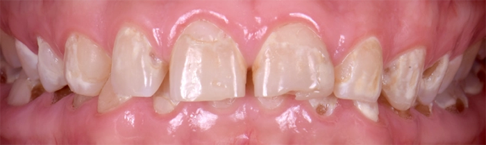 Saint Clair Dentaire – Dentisterie esthétique