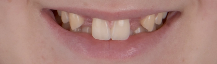 Saint Clair Dentaire – Dentisterie esthétique