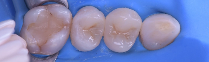 Saint Clair Dentaire – Dentisterie restauratrice