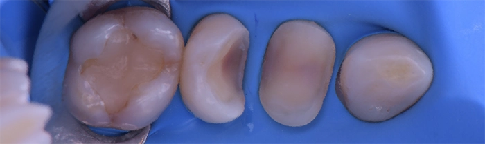 Saint Clair Dentaire – Dentisterie restauratrice