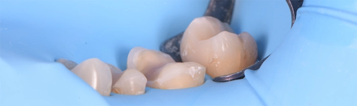 Saint Clair Dentaire – Dentisterie restauratrice