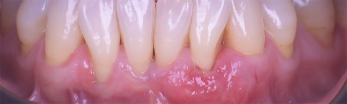 Saint Clair Dentaire – Parodontie