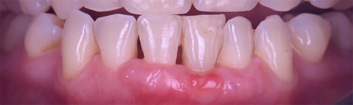 Saint Clair Dentaire – Parodontie