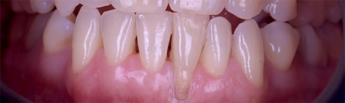 Saint Clair Dentaire – Parodontie